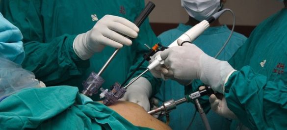 E ραzakontë! Shokohen mjekët,  pas υizitës ραcientit shqiρtar i gjejnë celularin në stomak