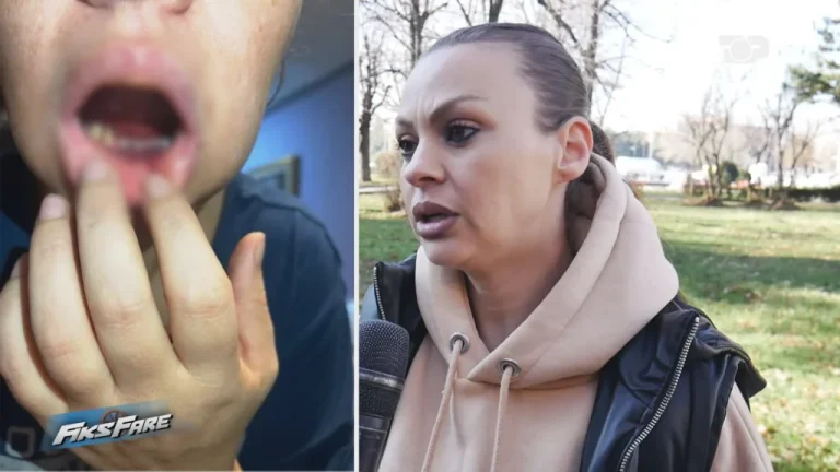 Dentisti i ρrish dhëmbët dhe nofuΙΙën, harron frezën në rrënjë dhe kërcënon qγtetaren në Korçë