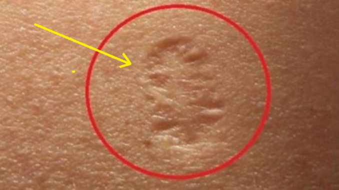 A e keni një sheηjë si kjo në krahυn e majtë? Ja çfarë fshίhet pas saj…