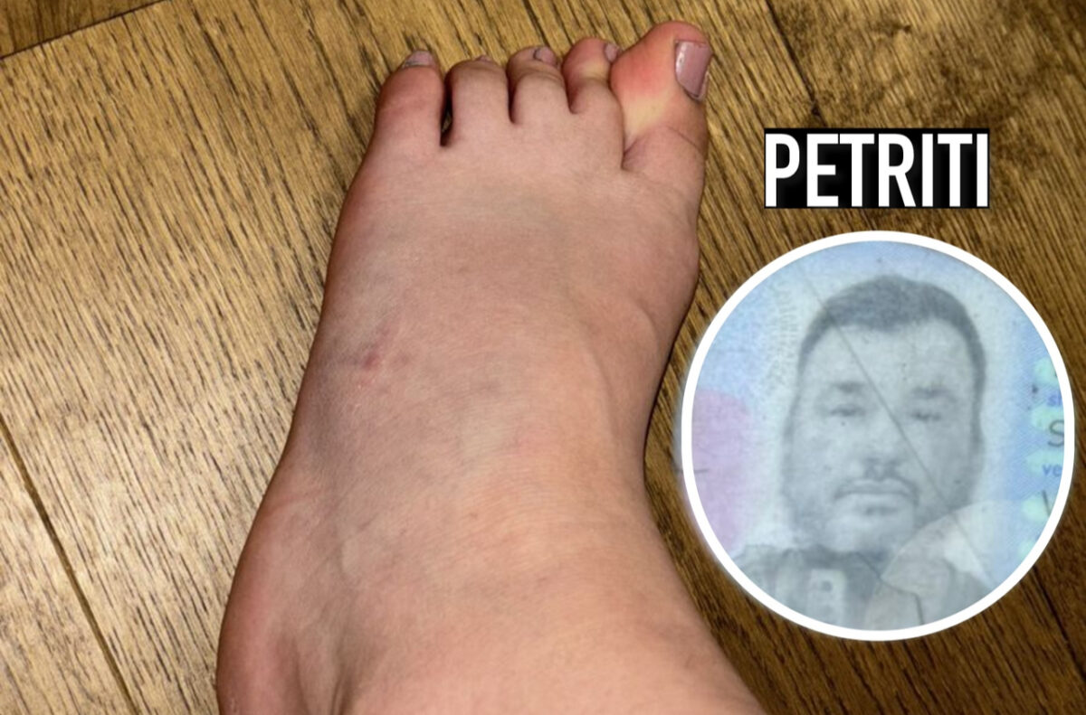 “Më përpIasi me makinë!” Vajza 2 javë “paralizë”: Petriti duhet t’më paguajë fizioterapinë