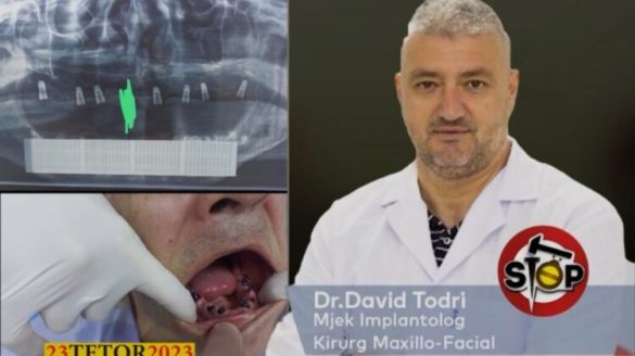 Rikthehet dentisti mashtrues, qytetarja paguan 3 mijë euro dhe mbetet pa dhëmbë në gojë