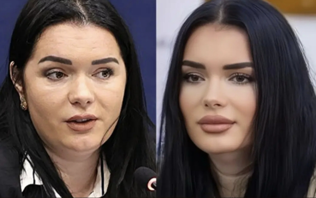 Vjedhja i nxjerr botoxin skarco drejtoreshës së OBP Arlinda Pogaj